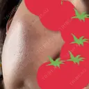 リジュラン ミニマムスキンクリニック池袋 DAY 10 サムネイル用