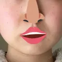 脂肪溶解注射（顔） / ルメッカ ブルームクリニック（BLOOM CLINIC） DAY 8 サムネイル用