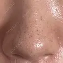 アグネス 日本美容・医療クリニック 六本木院 DAY 8 サムネイル用