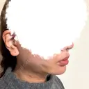 糸リフト / 脂肪吸引（顔） EMMA CLINIC（エマクリニック） DAY 14 サムネイル用