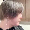 二重切開 / 目頭切開 / 眼瞼下垂（切開） / 隆鼻術 / 鼻中隔延長（切開） / 小鼻縮小（切開） / 骨切幅寄せ id（アイディ）美容外科 DAY 366 サムネイル用