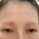 アートメイク除去・修正 渋谷美容外科クリニック 新宿院 AFTER サムネイル用