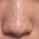 アグネス 日本美容・医療クリニック 六本木院 DAY 9 サムネイル用