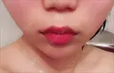 ヒアルロン酸注入（あご） / ボトックス（エラ・小顔） / ヒアルロン酸注入（唇） TCB東京中央美容外科 郡山院 AFTER サムネイル用