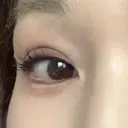 眉下切開 湘南美容クリニック 秋葉原院 DAY 1766 サムネイル用