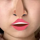 脂肪溶解注射（顔） / ルメッカ ブルームクリニック（BLOOM CLINIC） AFTER サムネイル用