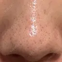 アグネス 日本美容・医療クリニック 六本木院 DAY 10 サムネイル用