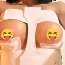 豊胸（シリコンバッグ） / その他（胸） お茶の水美容形成クリニック DAY 4 サムネイル用