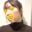 脂肪吸引注射（顔） ルラ美容クリニック 名古屋栄院 / ルラスキンクリニック 名古屋栄院 DAY 9 サムネイル用