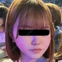 脂肪吸引（顔） / 脂肪吸引注射（顔） SEA CLINIC（シークリニック） DAY 31 サムネイル用