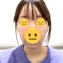 脂肪吸引注射（顔） ルラ美容クリニック 名古屋栄院 / ルラスキンクリニック 名古屋栄院 AFTER サムネイル用