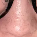 アグネス 日本美容・医療クリニック 六本木院 DAY 12 サムネイル用