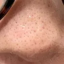 アグネス 日本美容・医療クリニック 六本木院 DAY 13 サムネイル用