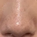 アグネス 日本美容・医療クリニック 六本木院 DAY 14 サムネイル用