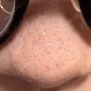 アグネス 日本美容・医療クリニック 六本木院 DAY 15 サムネイル用