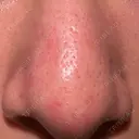 アグネス 日本美容・医療クリニック 六本木院 DAY 1 サムネイル用