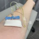 美容点滴・美容注射（美肌） Kinshicho Beauty Clinic （錦糸町ビューティークリニック） DAY 0 サムネイル用