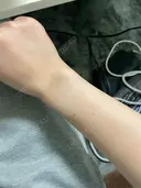 美容点滴・美容注射（美肌） Kinshicho Beauty Clinic （錦糸町ビューティークリニック） DAY 1 サムネイル用