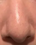 アグネス 日本美容・医療クリニック 六本木院 DAY 4 サムネイル用