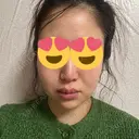 脂肪吸引（顔） / 脂肪吸引（お腹） / 脂肪吸引（腰） / ボトックス（エラ・小顔） Mods Clinic（モッズクリニック） 東京院 DAY 84 サムネイル用