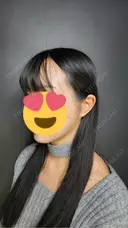 糸リフト / 脂肪吸引（顔） / ボトックス（あご） / ヒアルロン酸注入（あご） / ボトックス（エラ・小顔） / ヒアルロン酸注入（鼻翼基部） Tokyo Tensei Clinic 新宿院 AFTER サムネイル用