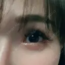 糸リフト / 目尻切開 / タレ目形成・グラマラスライン（切開） / ボトックス（あご） / ヒアルロン酸注入（あご） / ヒアルロン酸注入（鼻翼基部） Tokyo Tensei Clinic 新宿院 DAY 13 サムネイル用