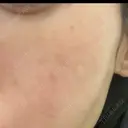 ルメッカ ルラ美容クリニック銀座院 DAY 0 サムネイル用