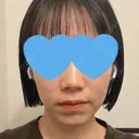 セットバック カトレア歯科・美容クリニック DAY 184 サムネイル用