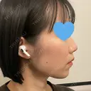 セットバック カトレア歯科・美容クリニック DAY 184 サムネイル用