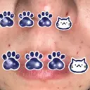 ほくろ・いぼ切除（肌） 形成外科と美容外科のクリニック池袋 DAY 8 サムネイル用