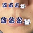 ほくろ・いぼ切除（肌） 形成外科と美容外科のクリニック池袋 DAY 10 サムネイル用