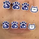 ほくろ・いぼ切除（肌） 形成外科と美容外科のクリニック池袋 DAY 12 サムネイル用