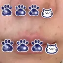 ほくろ・いぼ切除（肌） 形成外科と美容外科のクリニック池袋 DAY 13 サムネイル用