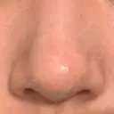 ピーリング（ハリ・ツヤ） Lumiera Clinic DAY 2 サムネイル用
