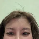 アートメイク（眉） LEAGRANT CLINIC 中目黒 DAY 6 サムネイル用