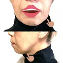 ボトックス（エラ・小顔） / ヒアルロン酸注入（頬） 新未来クリニック AFTER サムネイル用