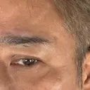 スネコス 日比谷セントラルクリニック DAY 7 サムネイル用