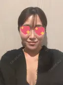 隆鼻術 / 鼻尖形成（切開） / 鼻中隔延長（切開） / 軟骨移植 / 斜鼻修正 / 鼻孔縁挙上 / 鼻翼基部形成（貴族手術） / 鼻柱下降・鼻唇角形成（猫手術） 4Dクリニック DAY 36 サムネイル用