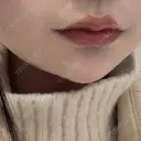 ヒアルロン酸注入（あご） / ボトックス（エラ・小顔） PRO CLINIC プロクリニック 銀座院 AFTER サムネイル用