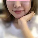 骨削り（頬） FROM B整形外科 (旧バウム整形外科) DAY 30 サムネイル用