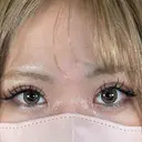 二重埋没 / 目頭切開 アリエル美容クリニック 大宮院 DAY 32 サムネイル用