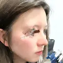 鼻尖形成（切開） / 鼻中隔延長（切開） / 軟骨移植 / 鼻修正 4Dクリニック DAY 17 サムネイル用