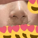 小鼻縮小（切開） アネシス美容クリニック DAY 0 サムネイル用