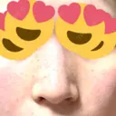 小鼻縮小（切開） アネシス美容クリニック DAY 7 サムネイル用