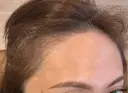 アートメイク（眉） / アートメイク（唇） / アートメイク（ヘアライン） LEAGRANT CLINIC 中目黒 DAY 10 サムネイル用