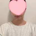 糸リフト / 脂肪吸引（顔） EMMA CLINIC（エマクリニック） DAY 32 サムネイル用
