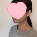 糸リフト / 脂肪吸引（顔） EMMA CLINIC（エマクリニック） DAY 90 サムネイル用
