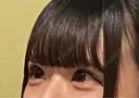 ヒアルロン酸注入（涙袋） Olino美容外科・美容皮膚科 AFTER サムネイル用
