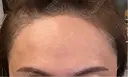 アートメイク（眉） / アートメイク（唇） / アートメイク（ヘアライン） LEAGRANT CLINIC 中目黒 DAY 11 サムネイル用