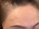 アートメイク（眉） / アートメイク（唇） / アートメイク（ヘアライン） LEAGRANT CLINIC 中目黒 DAY 11 サムネイル用